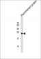 MLL3 Antibody